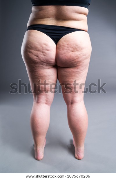 fat-female-body-cellulite-overweight-600
