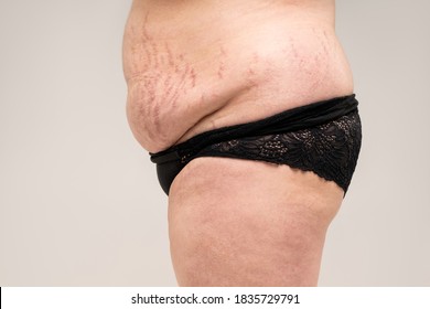 Fat flabby female belly with stretch marks on gray background, skin care concept - Shutterstock ID 1835729791
