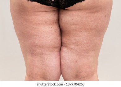 Thick Thigh Women Pics