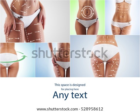 Fat lose, liposuction, sport, fitness, healthy eating, nutrition, fit shape and cellulite removal concept. Woman with arrows on her body.