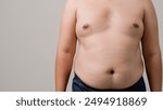 Fat man with a big belly worries about his body. Fat man has excess fat on a white background. Concept of unhealthy body need to figure out. Men at risk for diabetes Belly fat. Obesity concept.