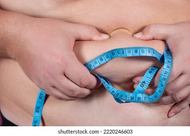 A Fat Man Holds His Stomach. Male Waist. Diet And Weight Loss. Obesity.