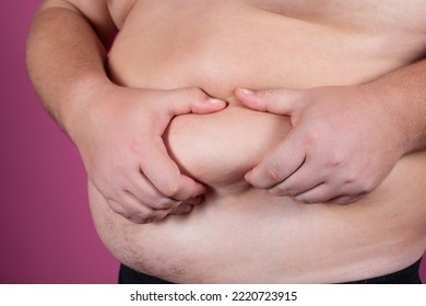 A Fat Man Holds His Stomach. Male Waist. Diet And Weight Loss. Obesity.