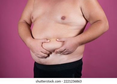 A Fat Man Holds His Stomach. Male Waist. Diet And Weight Loss. Obesity.