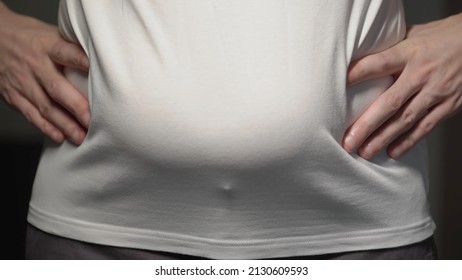 Fat Man. Man Touches His Stomach. Belly, Overweight. Oversize Person In A White Shirt Holds Skin. Slimming Diet, Liposuction And Unhealthy Lifestyle. Bold Male Waist.