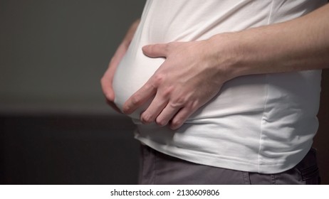 Fat Man. Man Touches His Stomach. Belly, Overweight. Oversize Person In A White Shirt Holds Skin. Slimming Diet, Liposuction And Unhealthy Lifestyle. Bold Male Waist.