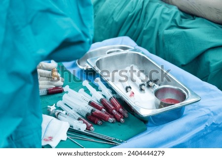 Fat in syringe for breast augmentation surgery in operation room.