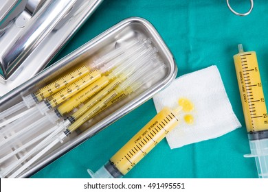 Fat Syringes On The Green Surgical Drapes For Fat Grafting Or Fat Transfer Procedure