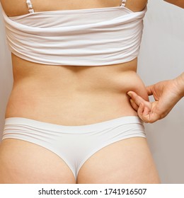 Fat unhealthy woman body. Pinch back side. Measurement lady procedure. Medicine pinching. Anti cellulite overweight.