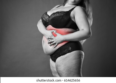 Fat Woman With Appendicitis Attack, Abdominal Pain, Stomach Ache, Overweight Female Body On Gray Background, Black And White Photo With Red Spots