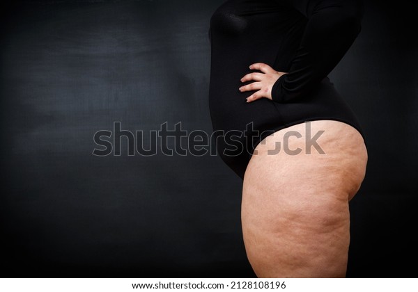 a fat woman with cellulite stands\
sideways on a black background. High quality\
photo