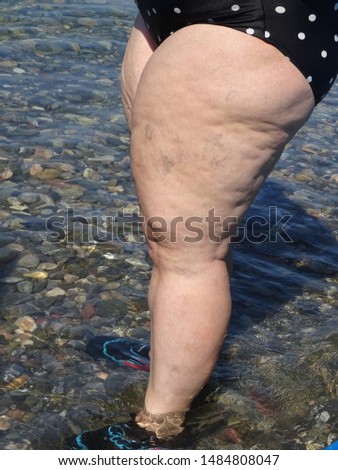 Fat woman with cellulite  in swimming suit on the beach.