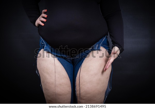 fat woman in ripped jeans on a black background.\
High quality photo