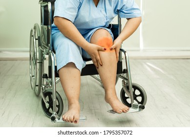 Fat Woman Sitting On Wheelchair Holding On Her Knee Pain.