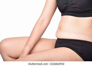 Fat Woman Sitting And Showing Belly Fat, Overweight Obesity Woman, Woman Muffin Top Waistline.