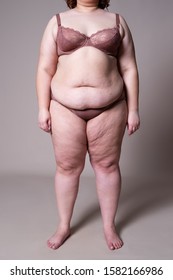 Ugly woman body