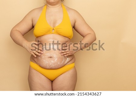 Fat woman in yellow swimsuit apply white body cream on thick sagging stomach, beige background. Slimming, fighting overweight, obesity and cellulite. Plus size people and body positive concept.