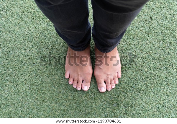 fat feet in flip flops