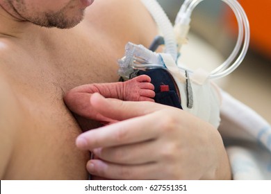 Father Holding A Premature Baby With An Oxygen Mask
In Kangaroo Method 