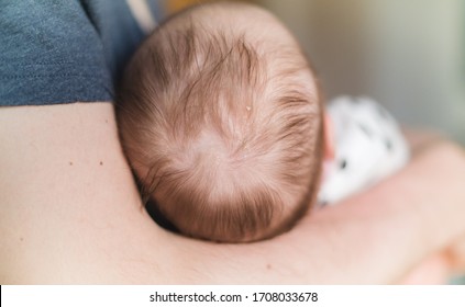 A Father Holiding A Newborn , Close Up On A Head (scalp) With Cradle Cap (infantile Seborrheic Dermatitis)