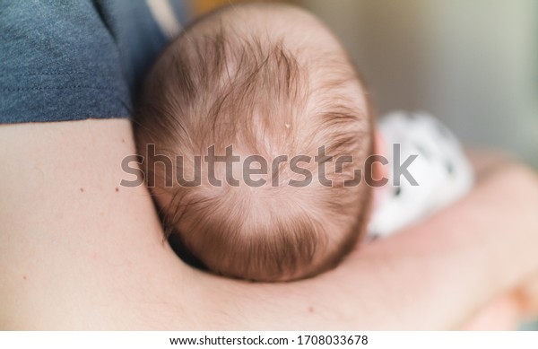 seborrheic dermatitis infant body