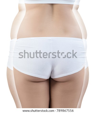 Fatty female buttocks before and after weightloss.