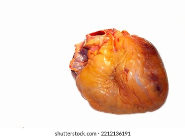 A Fatty Heart Isolated On A White Background With Symptoms Of Cardiac Distress