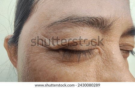 FCrow's feets with facial skin problems of freckles, dark spots and wrinkles on the faces of Asain women stressed expression, frowning, Rough skin, Isolated on white background and concept of healthy