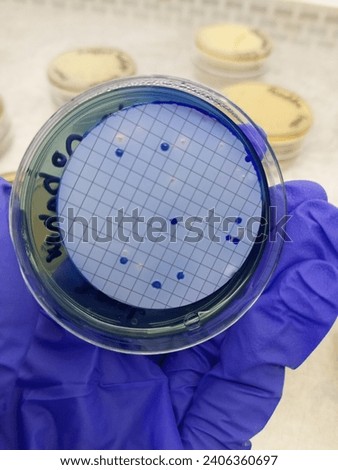 Fecal coliform growth on agar plate