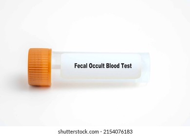 Fecal Occult Blood Test In Lab