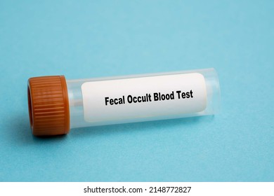 Fecal Occult Blood Test Stool Biological Sample In Medical Science Lab