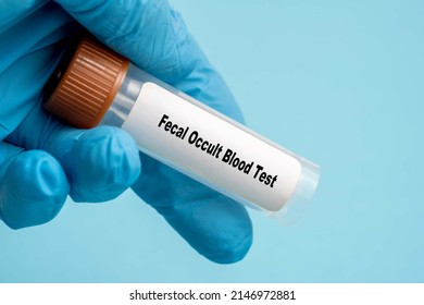 Fecal Occult Blood Test Test Tube In Medical Lab