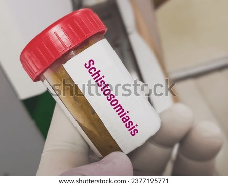 Fecal sample for Real time PCR Bilharzia test to diagnosis of schistosomiasis.