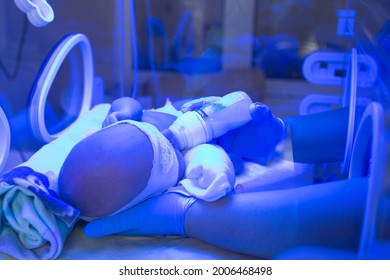 Feeding Baby In Intensive Care Unit In A Medical Incubator Under Ultraviolet Lamp. Phototherapy Treatment To Reduce Bilirubin Levels In Newborn Jaundice. Neonatal Icu.