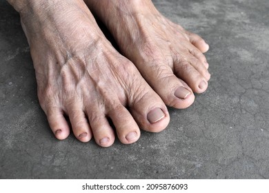 Granny Toes