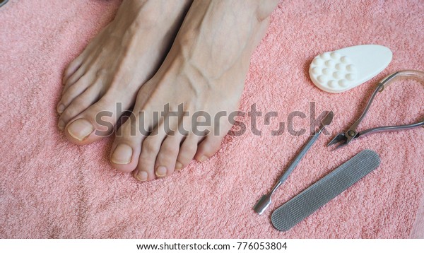 Feet Before Treatment Pedicure Stock Photo (Edit Now) 776053804