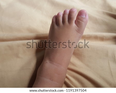 The feet of a child on a brown cloth.