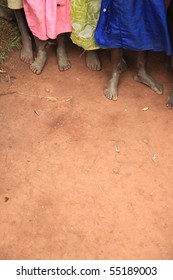 The Feet Of Children Living In Poverty In Uganda, Africa