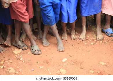 The Feet Of Children Living In Poverty In Uganda, Africa