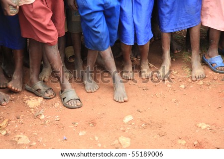 The Feet of Children Living in Poverty in Uganda, Africa