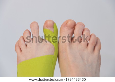 Feet close-up, top view. There is a tap on the big toe. Correction of finger deformity. Hallux valgus. Innovative medicine