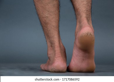 Alcohol and Glycerol – A Home Remedy for Rough Feet - Solutions for Skin  Care