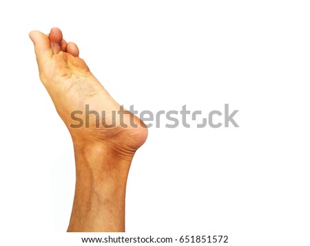 The Feet Or Foot Sole Of Asian Men Are Healthy The Feet Or Foot Sole Of Asian Men Are Healthy