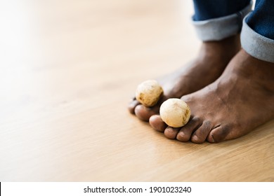 Foot Fungus Images, Stock Photos & Vectors | Shutterstock