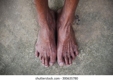 Long ebony feet
