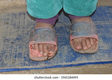 The Feet Of A Poor Child Suffers From Poverty And Misery