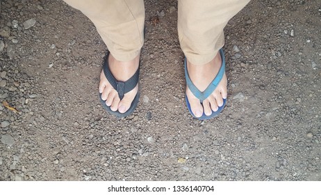 The Feet That Wear The Wrong Pair Of Sandals.