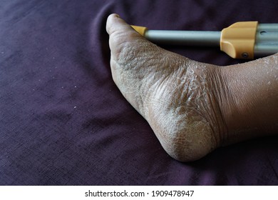 Cast Off Skin High Res Stock Images Shutterstock