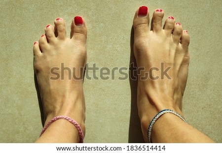 Feet of a woman with badly painted nails