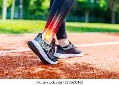 Female athlete walking on track field, low angle view of her shoes and ankle with x-ray image showing sportive injury. Sports injuries concept - Powered by Shutterstock